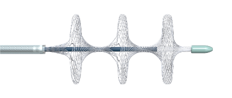 國內首創！本市研發生產的1款Ⅲ類創新醫療器械獲批上市，為具有溶栓禁忌癥的患者提供了治療選擇